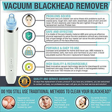 Load image into Gallery viewer, Professional Electric Blackhead Vacuum